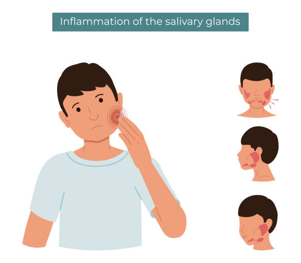 ilustraciones, imágenes clip art, dibujos animados e iconos de stock de ilustración plana vectorial de una persona con glándulas salivales inflamadas. el tipo siente dolor en la glándula salival. - salivary gland