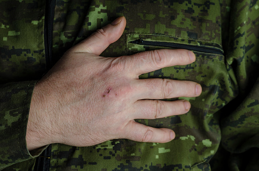 The officer puts his hand in his chest. The right hand of a man with damaged skin rests on his heart. A middle-aged adult male in a green camouflage uniform. Selective Focus. Low key. Indoors.