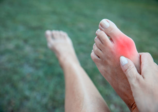 femelle ayant la douleur d’oignon à l’extérieur - big toe photos et images de collection