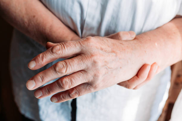 istock Older woman hands. Rheumatism, arthritis, joint pain 1312689324