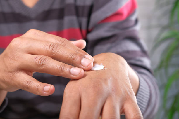 istock man applying beauty cream onto skin 1312825851