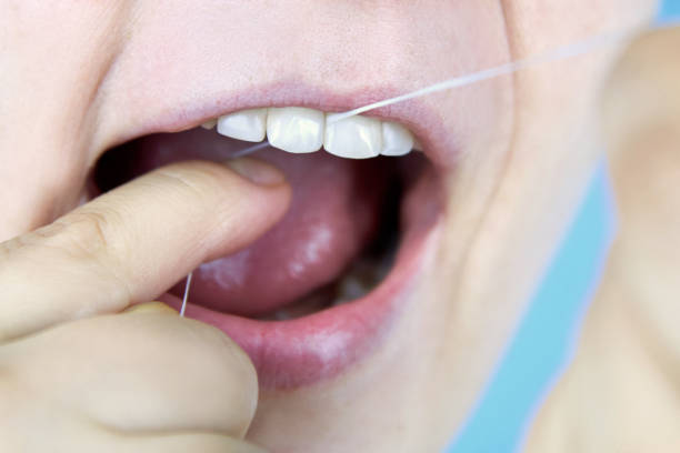 istock Woman brushing teeth with dental floss, close-up. 1312830770