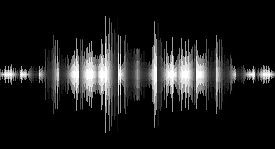 Sound wave. Abstract music pulse background. Equalizer indicators. Audio track wave graph. Vertical peaks. Vector illustration isolated on black.