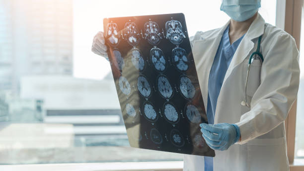nörolojik tıbbi tedavi için yaşlı yaşlanan hasta nörodejeneratif hastalık problemini teşhis eden manyetik rezonans görüntüleme (mrg) filmi gören tıp doktoru ile beyin hastalığı tanısı - alzheimer stok fotoğraflar ve resimler