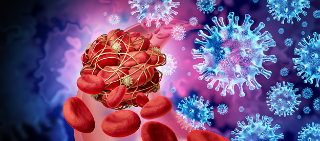 Blood clots and virus infection and Coronavirus or influenza as cells clumped together by sticky platelets and fibrin as a blockage in an artery or vein as a risk of clotting and clot concept with as a 3D render.