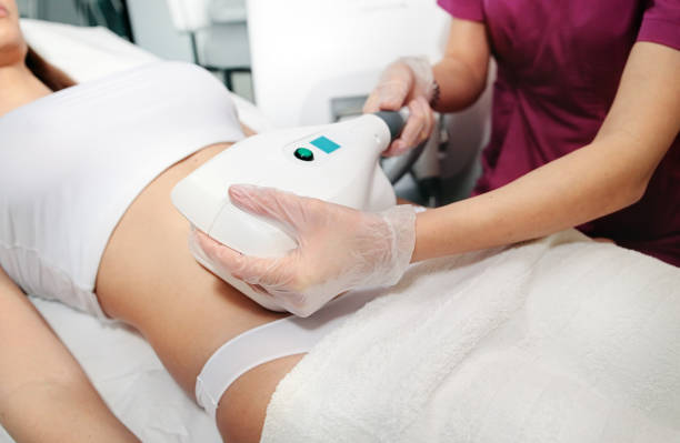 Cryolipolyse and body contouring treatment, anti-cellulite and anti-fat therapy in beauty salon stock photo