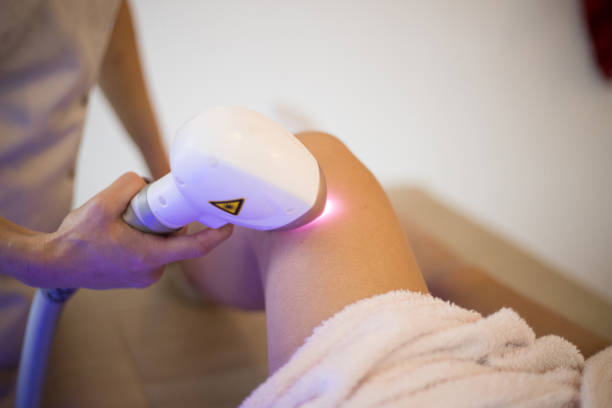 traitement de beauté - laser hair removal photos et images de collection