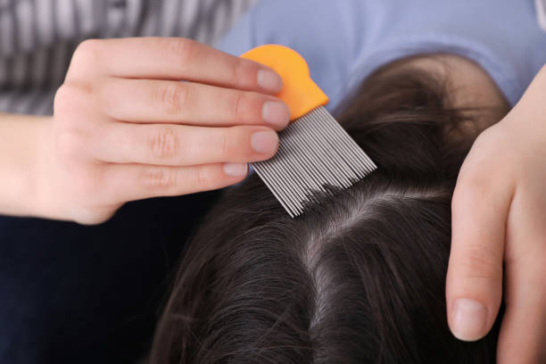 istock Mother using nit comb on her daughter's hair indoors. Anti lice treatment 1313436041