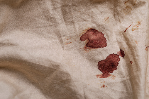Dried blood stain on fabric from an elbow wound.
