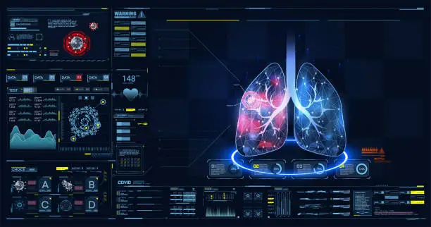 Vector illustration of HUD, GUI, FUI dashboard element ui medical examination. Display set of virtual interface elements. Covid-19. Human lungs. Low poly wireframe and points. Diagrams, pie chart infographics. Vector