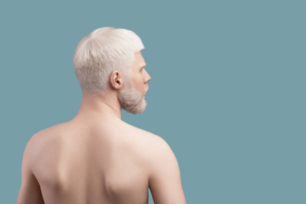 concept d’anomalie de peau. dos du jeune homme albinos mince, posant dans le studio au-dessus du fond turquoise, regardant de côté - young men portrait fine art portrait men photos et images de collection