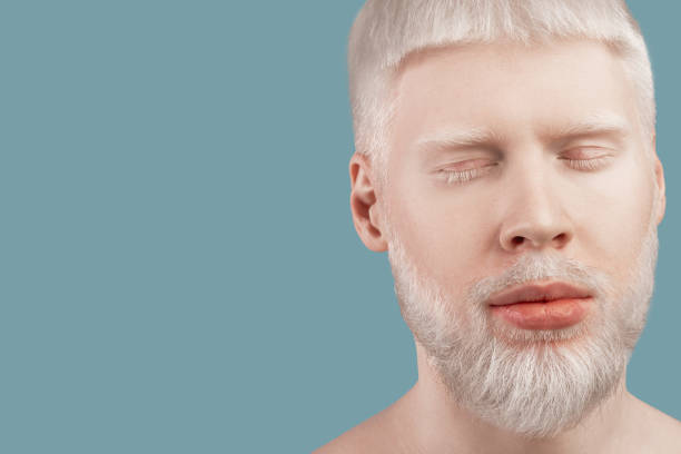 istock Bearded albino man posing with closed eyes against turquoise studio background, empty space. Albinism concept 1313786118