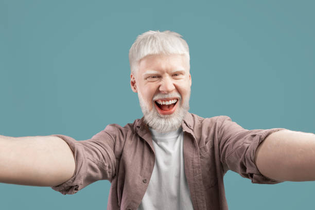 istock Happy albino guy with unusual appearance taking selfie on turquoise studio background, smiling at camera and having fun 1313786143