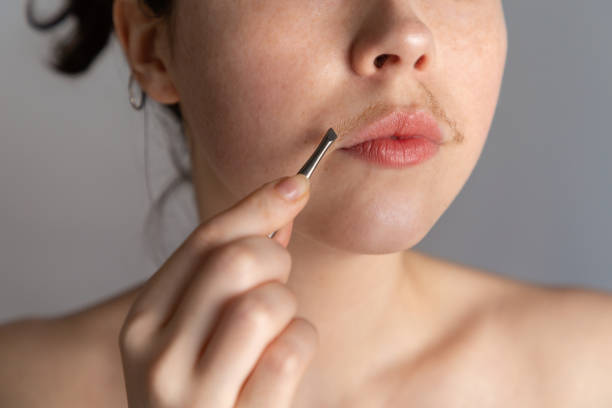 口ひげを持つ若い女性は、ピンセットで彼女の唇の上の髪を削除しようとします。不要な顔の毛を取り除くという概念。クローズアップ - 顔の毛 ストックフォトと画像