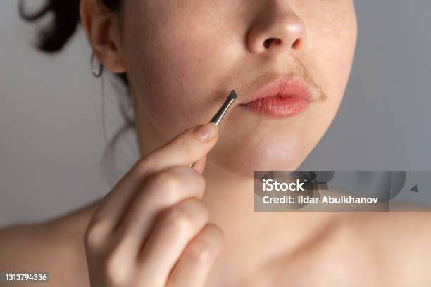 A Young Woman With A Mustache Tries To Remove The Hair Over Her Lip With  Tweezers