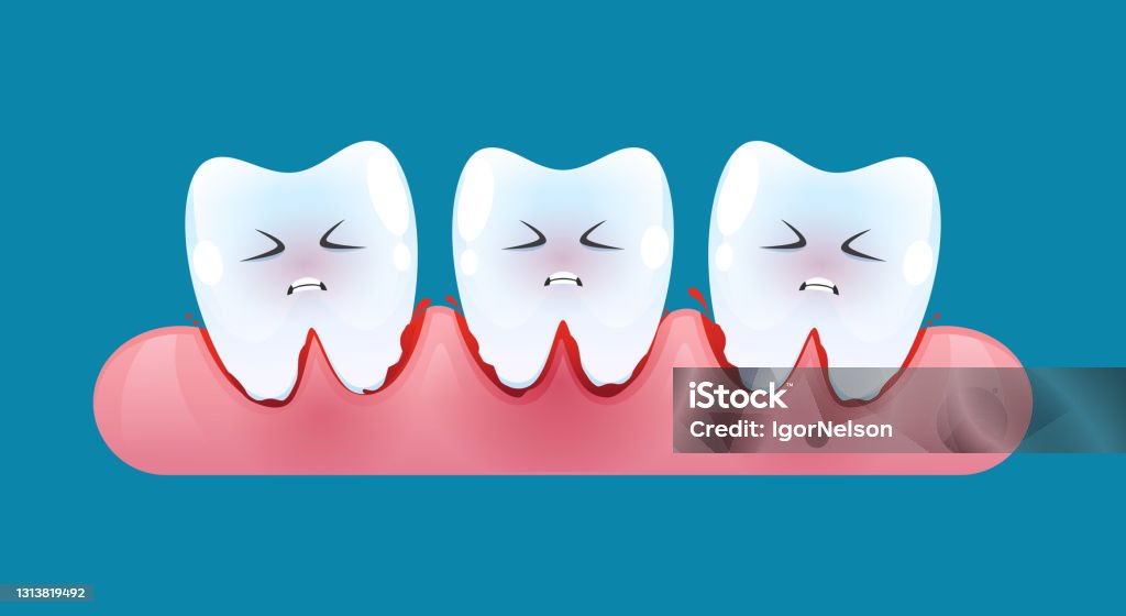 Tooth Is Bleeding In The Gum Blood Teeth Vector Cartoon Style Stock