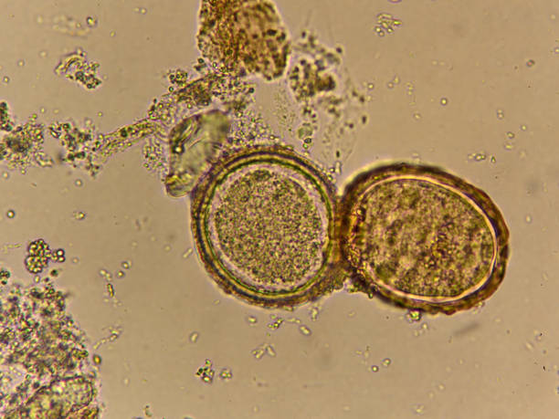 istock Egg of Ascaris lumbricoides (roundworm) 1313856177