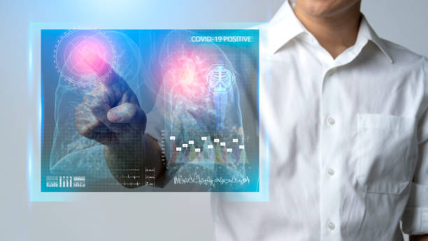 asian reseacher check lung chest of covid-19 patient xray report with positive result of infection detech corona virus outbreak epidemic ,analysis of effect from covid in human body test concept reseacher asiático revisar el pecho pulmonar de covid-19 paciente xray informe con resultado positivo de la epidemia de brote del virus de la infección detech corona, análisis del efecto de covid en el concepto de prueba del cuerpo humano