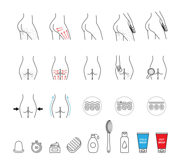 Anti-cellulite icons set editable stroke Anti-cellulite icons set editable stroke cellulite stock illustrations