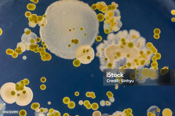 Backgrounds Of Characteristics And Different Shaped Colony Of Bacteria And Mold Growing On Agar Plates From Soil Samples For Education In Microbiology Laboratory Stock Photo - Download Image Now