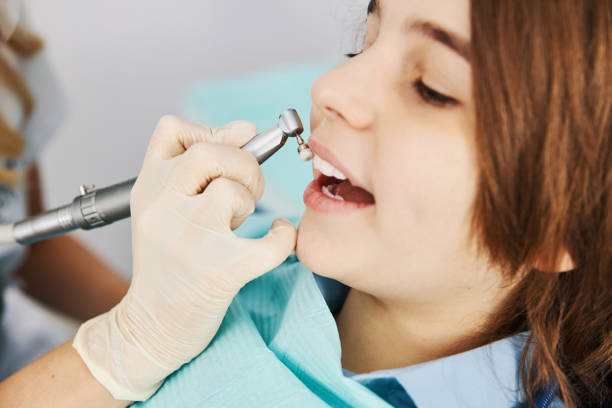 istock Dental drill with prophy brush treating boy teeth 1314217581