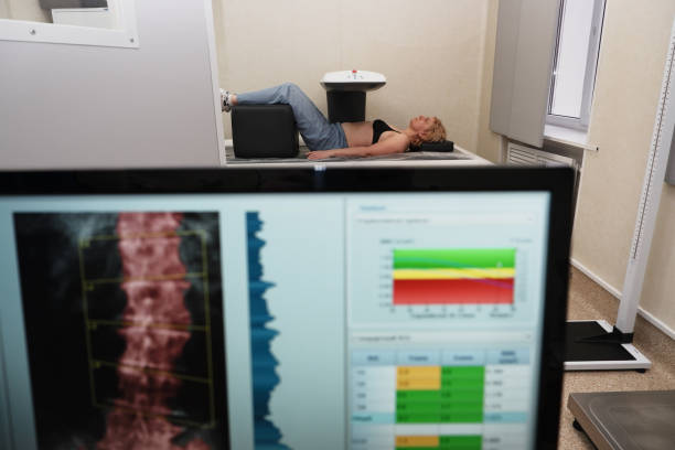 골밀도 ��측정 장치를 사용하여 인간의 뼈의 밀도에 대한 조사. - human spine mri scan x ray doctor 뉴스 사진 이미지