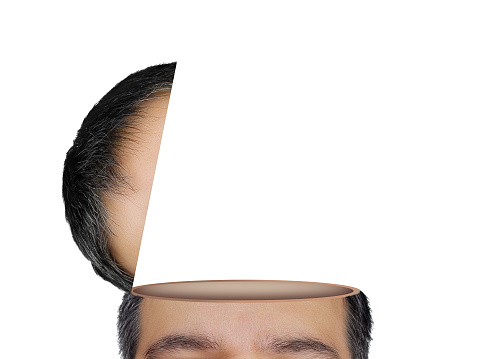 Portrait of a man with open head manipulation surreal image solated on white background. He has empty head ideal for adding elements like lightbuld, idea, gears, thoughts