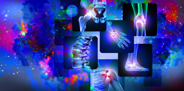 Joint Pain Background Pain of the joints concept background as skeleton and muscle anatomy of the body with a group of sore joints as a painful injury or arthritis illness symbol for health care and medical symptoms with 3D illustration elements. rheumatoid arthritis stock pictures, royalty-free photos & images