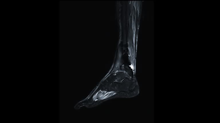 Mri Leg Performance 500+ Leg Mri Stock Videos and Royalty-Free Footage - iStock