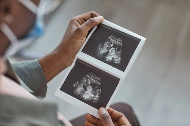 immagine ad ultrasuoni in mano alla donna - scansione scientifica foto e immagini stock