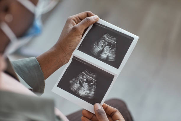 Ultrasound image in woman's hand Close-up of woman looking at ultrasound image in her hands during her visit at hospital ultrasound photos stock pictures, royalty-free photos & images