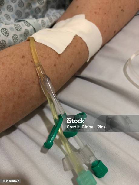 Colcansentine Injeksi Obat Yang Diberikan Oleh Injeksi Intravena Foto Stok - Unduh Gambar ...