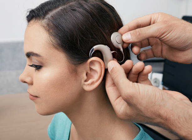 人工内耳。聴覚を回復するための女性の耳に設置人工内耳 - 人間の耳 ストックフォトと画像