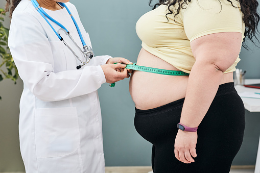 Obesidad, peso poco saludable. Nutricionista inspeccionando la cintura de una mujer usando una cinta de medidor para recetar una dieta para bajar de peso photo
