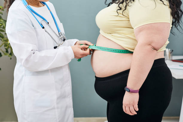 obesidad, peso poco saludable. nutricionista inspeccionando la cintura de una mujer usando una cinta de medidor para recetar una dieta para bajar de peso - consumption scale fotografías e imágenes de stock