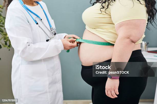 Obesity Unhealthy Weight Nutritionist Inspecting A Womans Waist Using A Meter Tape To Prescribe A Weight Loss Diet Stock Photo - Download Image Now
