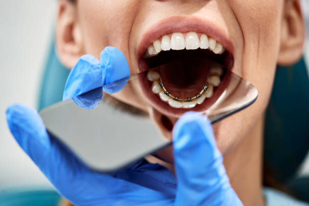 istock Close-up of dentist using mirror while checking dental braces on the back side of patient's teeth. 1314828598
