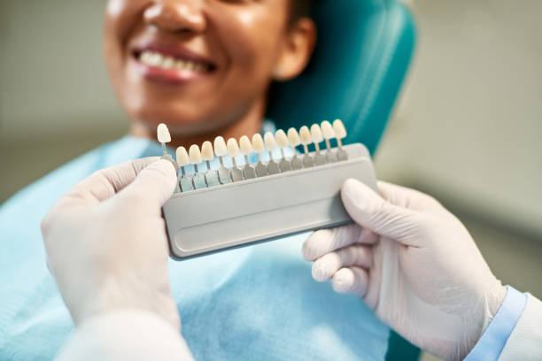 el primer plano del dentista elige el tono correcto de los implantes durante la cita dental con la paciente femenina. - blanqueamiento dental fotografías e imágenes de stock