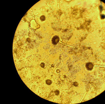 Aspergillus fumigatus is one of the most common Aspergillus species to cause disease in individuals with an immunodeficiency. This pathogen primarily causes invasive infection in the lung.