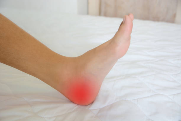 istock Women's heel pain 1315114209