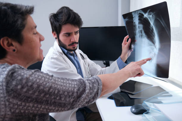 young doctor examining x-ray of a broken rib with a woman mature patient. radiography of a chest. - pain rib cage x ray image chest imagens e fotografias de stock