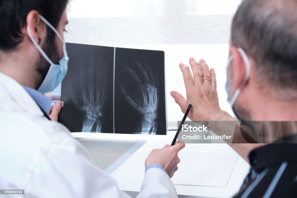 Young doctor examining x-ray of hands of a senior patient with arthritis. Radiography of a hand. Rheumatology Stock Photo