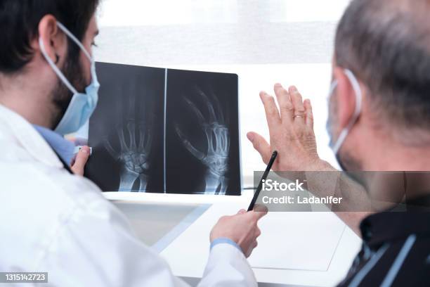 Young Doctor Examining Xray Of Hands Of A Senior Patient With Arthritis Radiography Of A Hand Stock Photo - Download Image Now