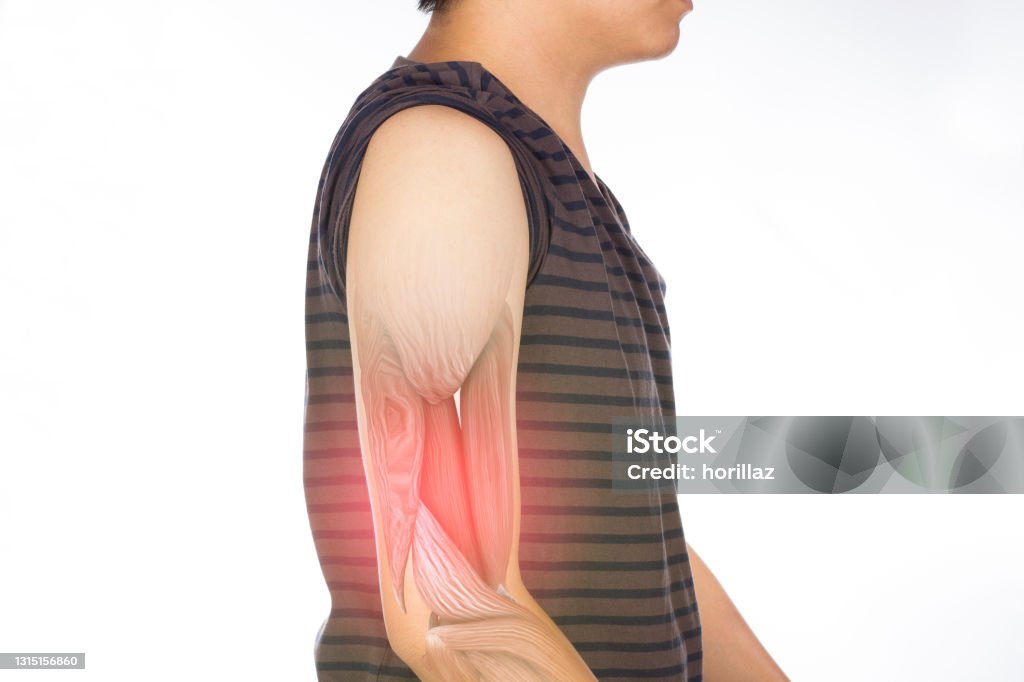 arm muscle injury arm muscle injury white background arm pain Bicep Stock Photo