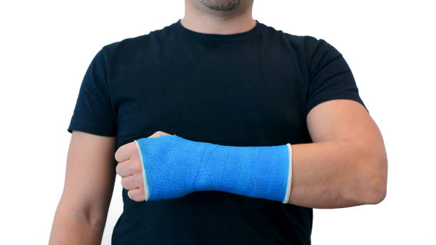 istock Man shows hand in plaster cast on white background 1315159862
