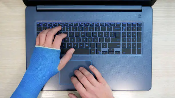 Top view of one hand scrolls on touchpad, other hand wrapped in fiberglass plaster cast typing on a laptop computer on a keyboard. A freelancer with one broken wrist works the Internet at home