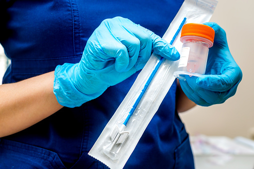 Ginecólogo sostiene un cepillo para muestrear citología líquida photo