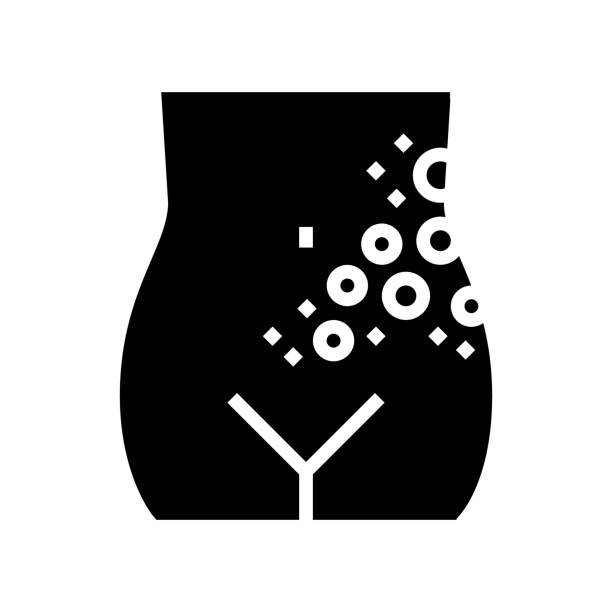 lichen shingles disease glyph icon vector illustration lichen shingles disease glyph icon vector. lichen shingles disease sign. isolated contour symbol black illustration bloody nose stock illustrations