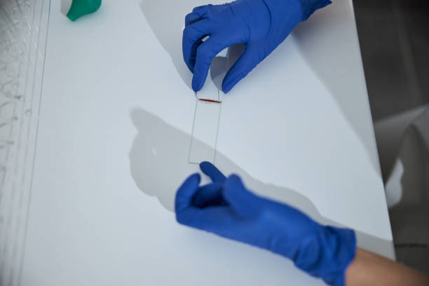 istock Qualified medical lab technician preparing a specimen for microscopic examination 1315366476