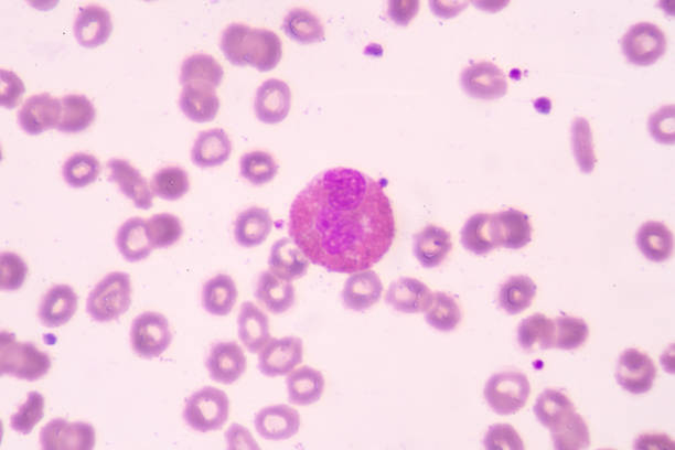 istock Orange granule Eosinophil white blood cells on red blod cell background. 1315369495
